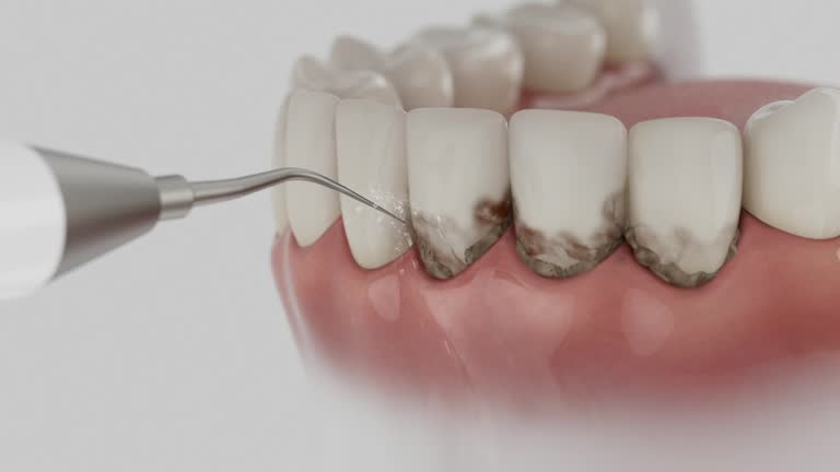 Trusted Tooth Extraction service in Woodbridge, VA - Dentist Open Now
